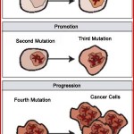 CANCER INFO…